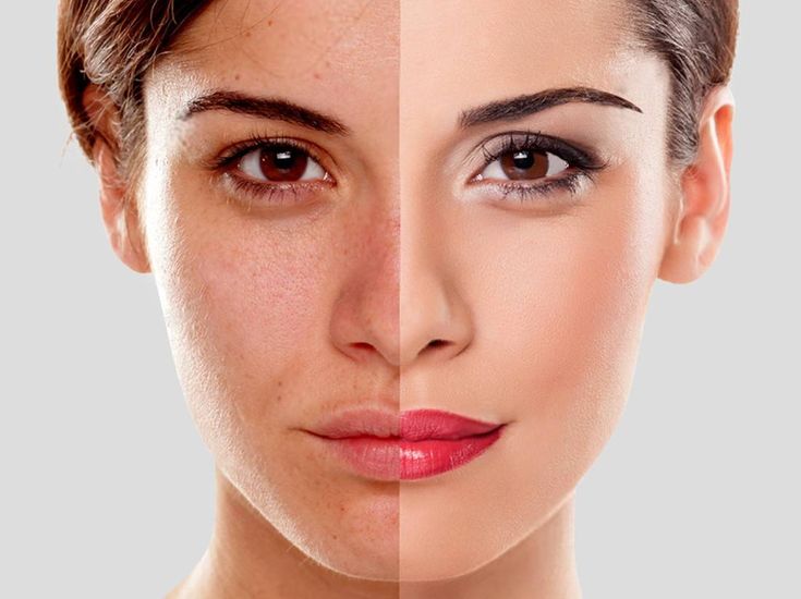 Retouching